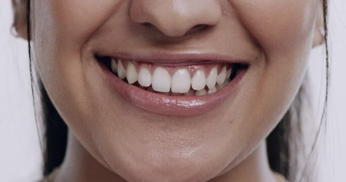 Smile, person and teeth whitening with closeup of mouth, orthodontics and wellness for oral health on white background. Dental, veneers and happy in studio, hygiene and grooming with fresh breath