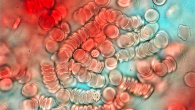 Human Blood under the microscope with visible red blood cells 
