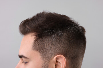 Obraz premium Man with dandruff in his dark hair on light grey background, closeup