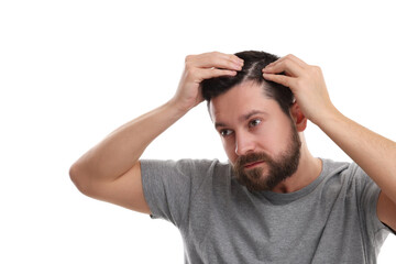 Man with dandruff in his dark hair on white background