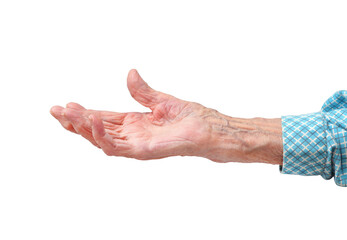Rheumatoid polyarthritis of the hand of a 95-year-old woman, isolated on a white background. Woman with outstretched hand.