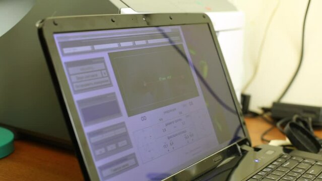 Data from refractometer on display screen during check eyesight.