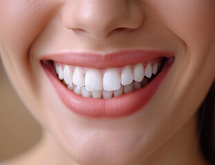 a smile with well-groomed clean white teeth close-up Ai generative