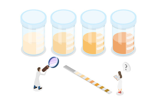 3D Isometric Flat  Conceptual Illustration of Urine Solution Stages, Liquid in a Glass Laboratory Beaker