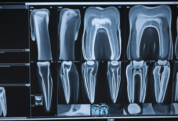 Dental imaging for professional diagnosis. Promoting dental health through X-rays.