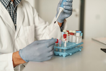 Close up of scientist is using micropipette for biochemical test analysis in medical laboratory