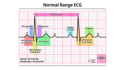 Normal Range ECG - PR Interval, QRS Complex, QT Interval, P and T Wave - Electrocardiogram Medical Vector Illustration