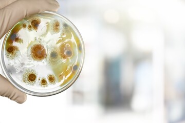 The rise of bacterial infections microbiological culture in Petri dish