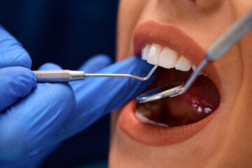 Close up of woman having teeth examination at dentist's office.