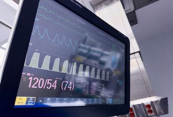 hospital monitor displaying vital signs, emphasizing healthcare, technology, and patient well-being