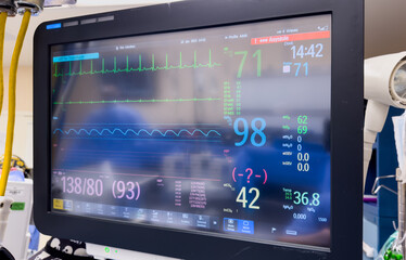 hospital monitor displaying vital signs, emphasizing healthcare, technology, and patient well-being