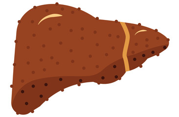liver, cirrhosis disease. Human liver organ anatomy vector illustration on white background.Stage Of liver Disease Concept,Unhealthy Liver,Cirrhosis Medical Education,sad,red,yellow