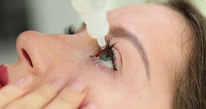 Woman applies eye drops to dry, irritated eyes
