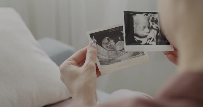 Close-up of female hands holding ultrasound image of unborn baby while future mother watching pictures indoors. Pregnancy and motherhood concept.