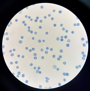  Reticulocytes is red blood cell immature.