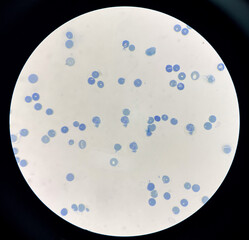  Reticulocytes is red blood cell immature.