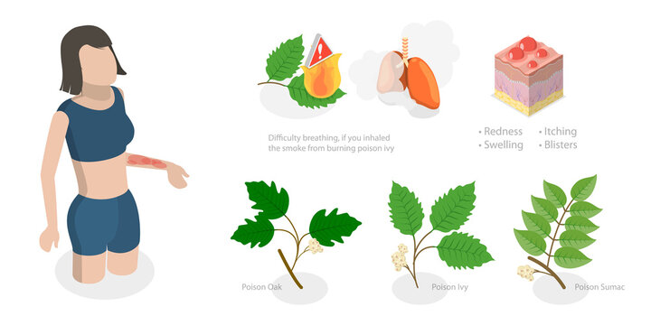 3D Isometric Flat  Conceptual Illustration of Poison Ivy, Allergy to Poison Plants