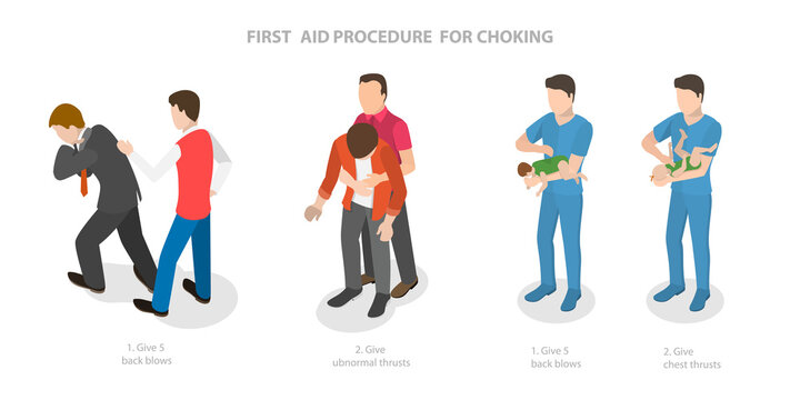 3D Isometric Flat  Conceptual Illustration of First Aid Procedure For Choking, Heimlich Maneuver