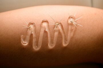 Transparent gel and spines on the light delicate female skin before hair removal