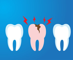 vector icon of healthy teeth and cavities, vector illustration, health, suitable for background