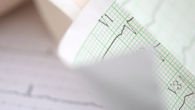 EKG heart rhythm recording on paper used by doctors in analysis of heart disease treatment illustration on white background. Macro image