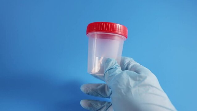 feces analysis,test bank for detecting diseases of the intestines and gastric tract