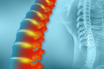 Human spinal cord injury, back pain on blurred background. 3d illustration - obrazy, fototapety, plakaty