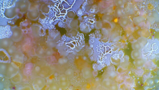 Time lapse of bacterial growth of bacterial colonies in a Petri dish during metagenomic analysis research