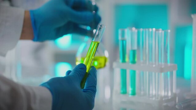 Medical analysis. A scientist examines a test tube with a substance in a medical laboratory. An experienced specialist, holding a flask in his hand, conducts a detailed analysis of experimental data