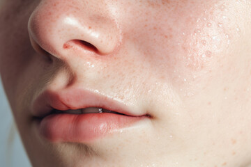 Fototapeta premium Detailed Close-up of Sweaty Skin with Freckles