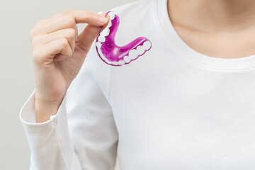 Dental invisible braces, close up hand of young woman holding invisalign braces, wearing orthodontic purple color metal. White teeth using invisible whitening tray. Stomatology, healthcare of dental.