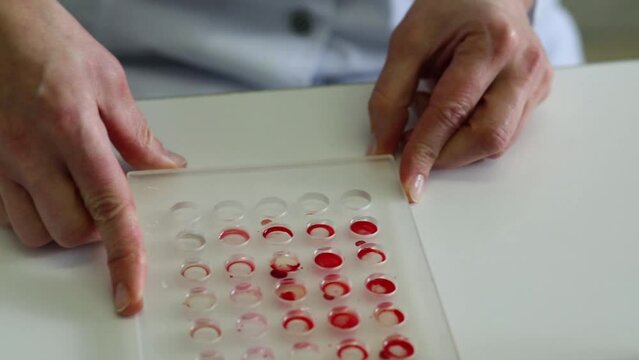 medical laboratory worker holds cuvette for definition of blood type