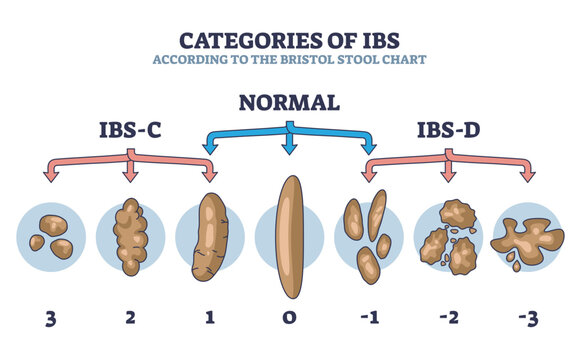 Categories of IBS stages according to bristol stool chart outline diagram, transparent background. Labeled educational scheme with normal and abnormal excrement structures illustration.