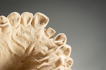 The image of a denture	