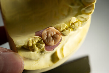  The image of a denture