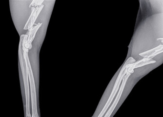 Digital front and side view X ray of the  foreleg of a cat with a fracture of the upper arm bone (humerus). Isolated on black
