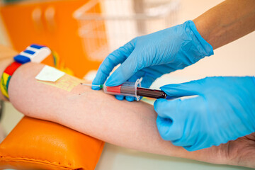 Fototapeta na wymiar A person undergoes a blood test on their arm to obtain important medical information.