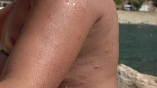Akcagerme Beach, Kas, Turkey - 7th of September 2023: 4K Viewing rush on the wet body of a boy on the beach, close up
