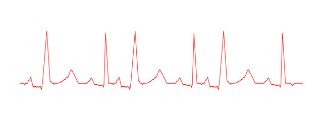 Heartbeat diagram. ECG chart. Cardiac rhythm red line. Cardio test sign. Pulse curve. Cardiology hospital symbol isolated on white background - obrazy, fototapety, plakaty