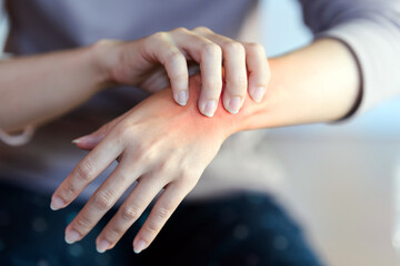 A woman touches a red area on her wrist to indicate the pain point.