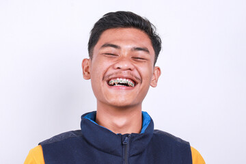 Portrait of cheerful young Asian man with dental braces laughing at camera