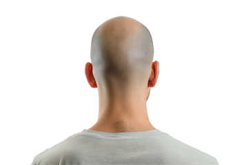 Rear view of a bald male head and upper shoulders isolated on a white background