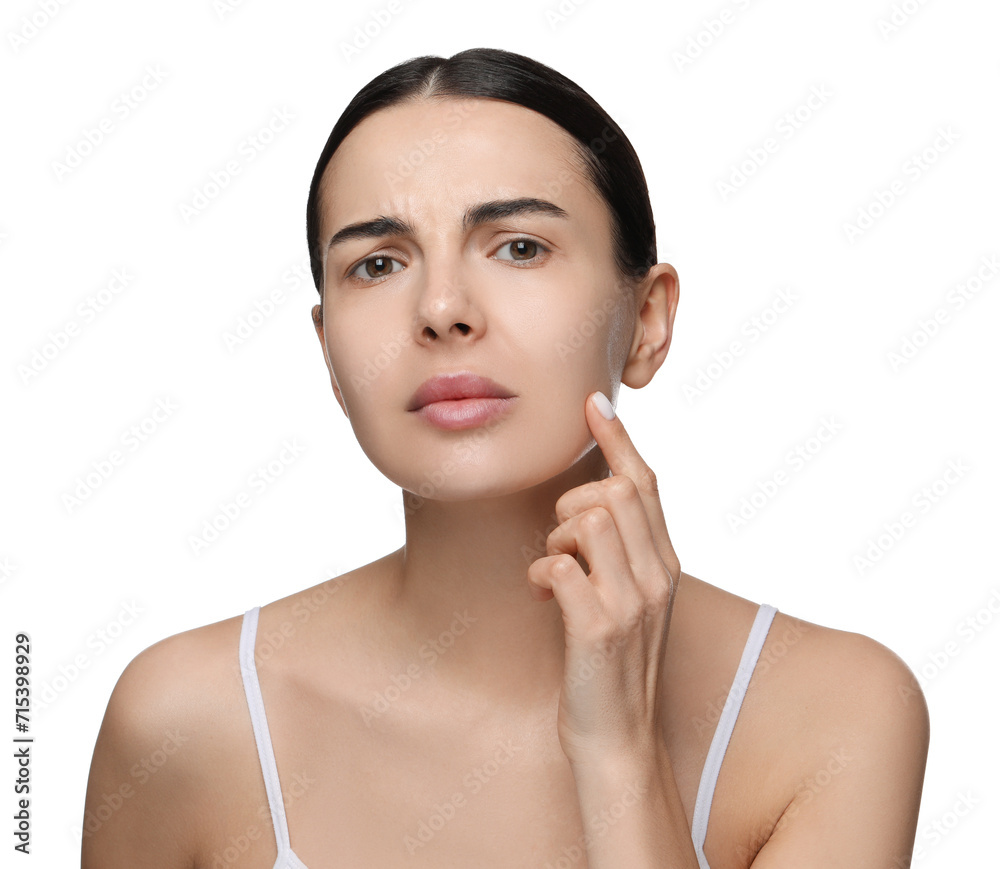 Poster Young woman with dry skin on white background