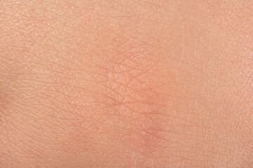 Texture of healthy skin as background, macro view