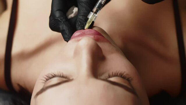 Injection procedure for lip augmentation, close-up. The cosmetologist slowly and carefully injects filler into the client&rsquo;s lips. Advertising concept for facial care, youth and beauty.
