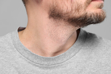 Obraz premium Closeup view of man with normal skin on grey background