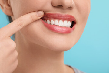 Woman showing her clean teeth on light blue background, closeup