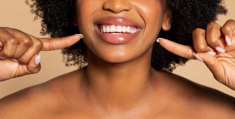 Smiling black woman pointing to her healthy white teeth