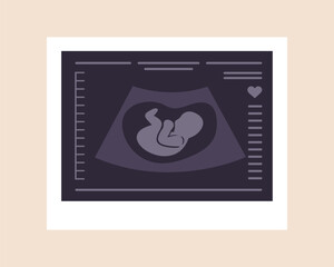 Ultrasound of baby. Embryo in womb. Pregnancy screening. Baby health diagnostic. Fetus silhouette photo. Sonography or ultrasonography concept. Vector illustration in flat cartoon style.
