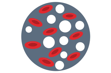 Fototapeta premium leukemia. Blood cancer. Red and white blood cells. Isolated vector illustrations in cartoon style.normal blood and leukemia.Red and white Blood,Leukemia icon. White and red blood cells,red